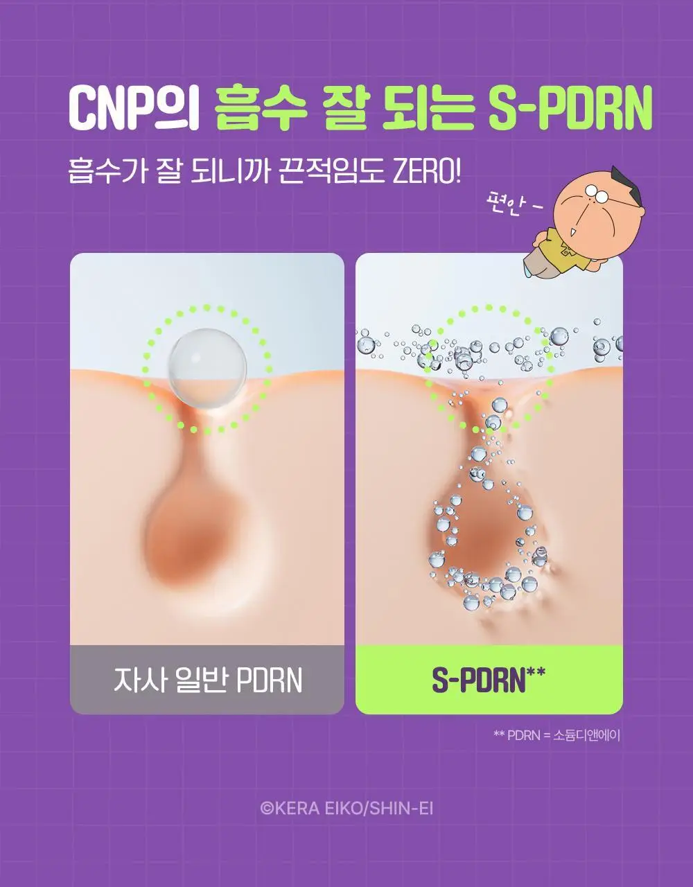 [90ml대용량]차앤박 더마앤서 액티브 부스트 PDRN 앰플 30ml+60ml 리필+대형스티커 (아따맘마 콜라보) 상세페이지 13